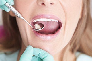 Closeup of smile during dental exam