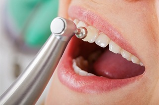 woman having her teeth polished