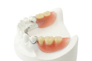Partial denture to replace molars against white background