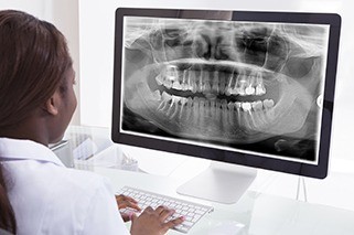 Dentist looking at digital x-rays