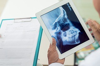 X-ray of jaw and skull bone