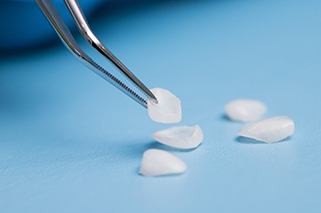 Close up of dental tweezers carefully holding a composite veneer