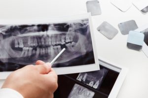 examining dental x-ray