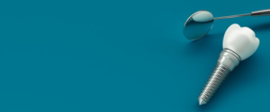 Dental implant and dental mirror on blue background