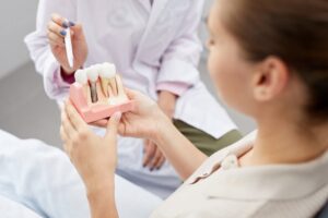 Dentist showing patient a model of a dental implant. 